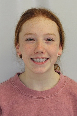 Teen girl with beautifully aligned smile after braces