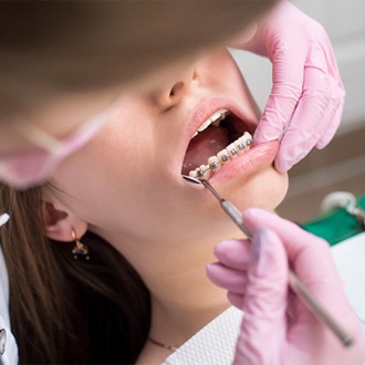 Orthodontist examining patient's braces