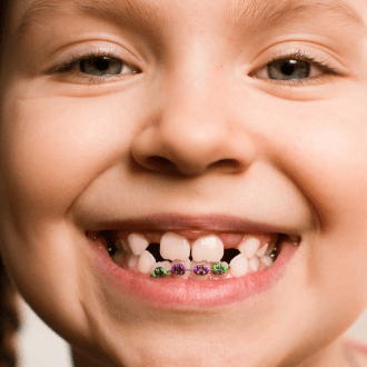 Closeup of child during pediatric orthodontic treatment