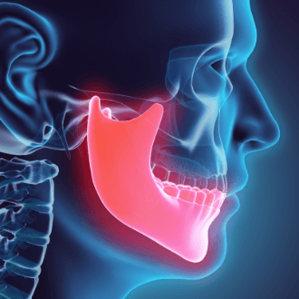 3 D animation of jaw and skull bone during dentofacial orthopedics