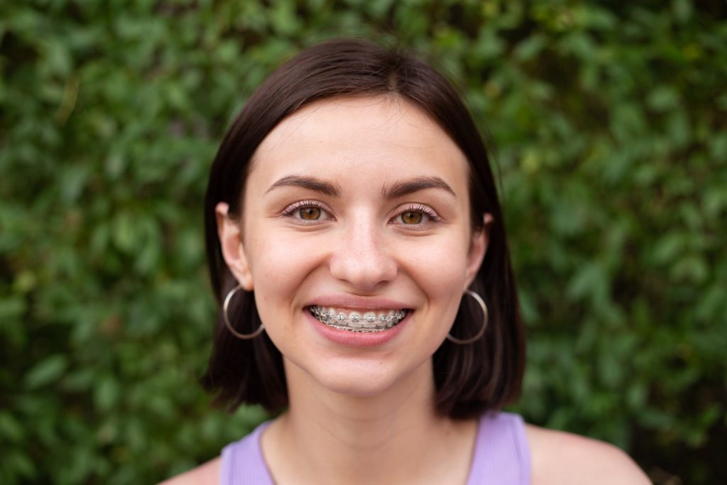 Closeup of woman with metal braces smiling