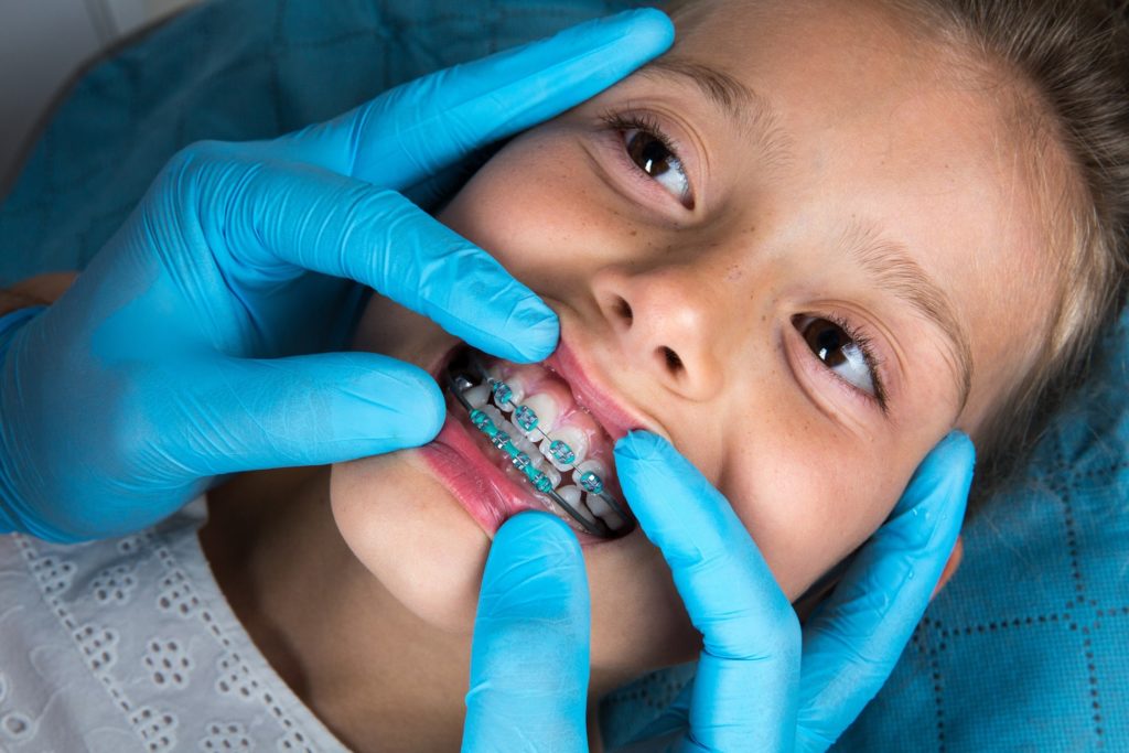 Orthodontist examining patient with braces on baby teeth